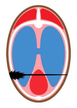 terminal ballistics